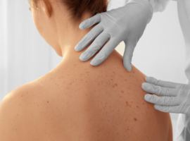 Dermatology